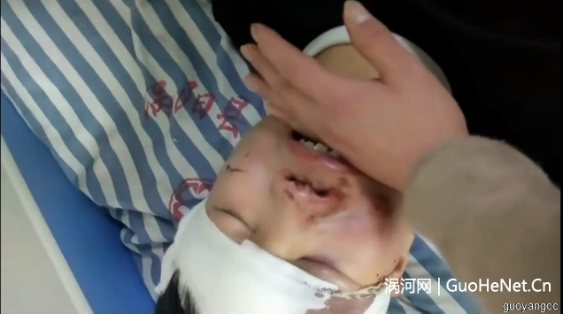 痛心！涡阳又一起学生坠楼，摔得满脸是血，咋回事？ 